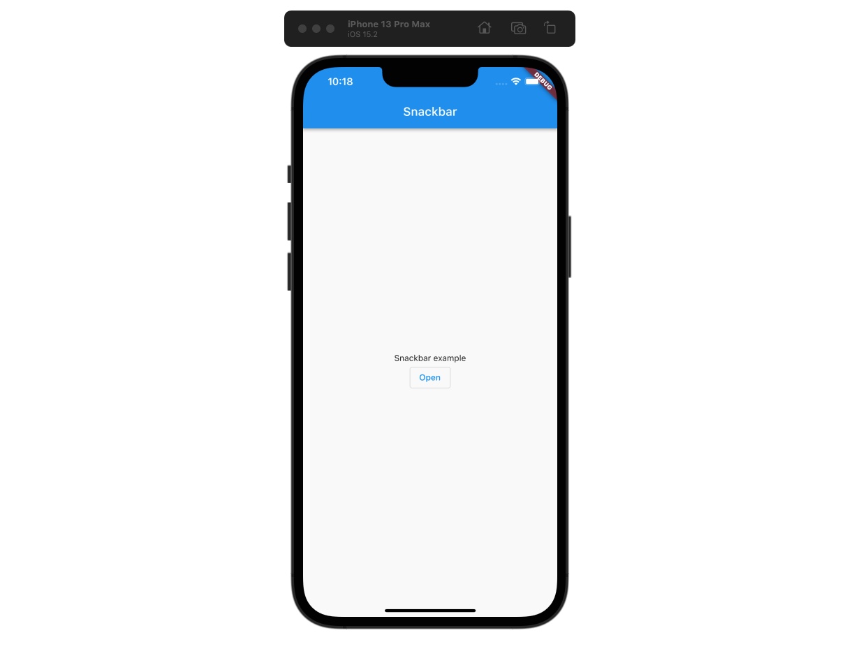 Flutter - GetX snackbar open button